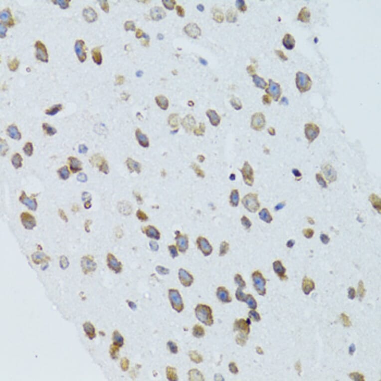 Immunohistochemistry - Anti-MOAP1 Antibody (A12599) - Antibodies.com