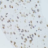 Immunohistochemistry - Anti-MOAP1 Antibody (A12599) - Antibodies.com