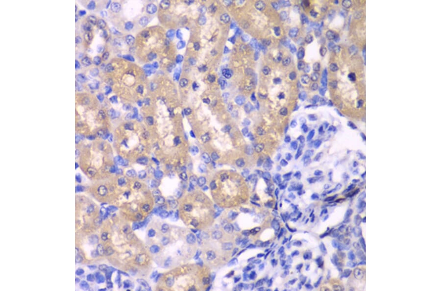 Immunohistochemistry - Anti-RPS6KB1 Antibody (A0447) - Antibodies.com