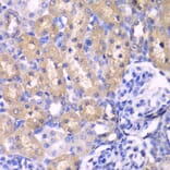 Immunohistochemistry - Anti-RPS6KB1 Antibody (A0447) - Antibodies.com