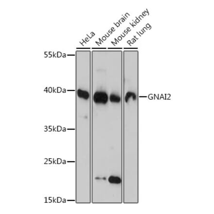 Western Blot - Anti-GNAI2 Antibody (A92125) - Antibodies.com