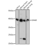 Western Blot - Anti-GNAI2 Antibody (A92125) - Antibodies.com