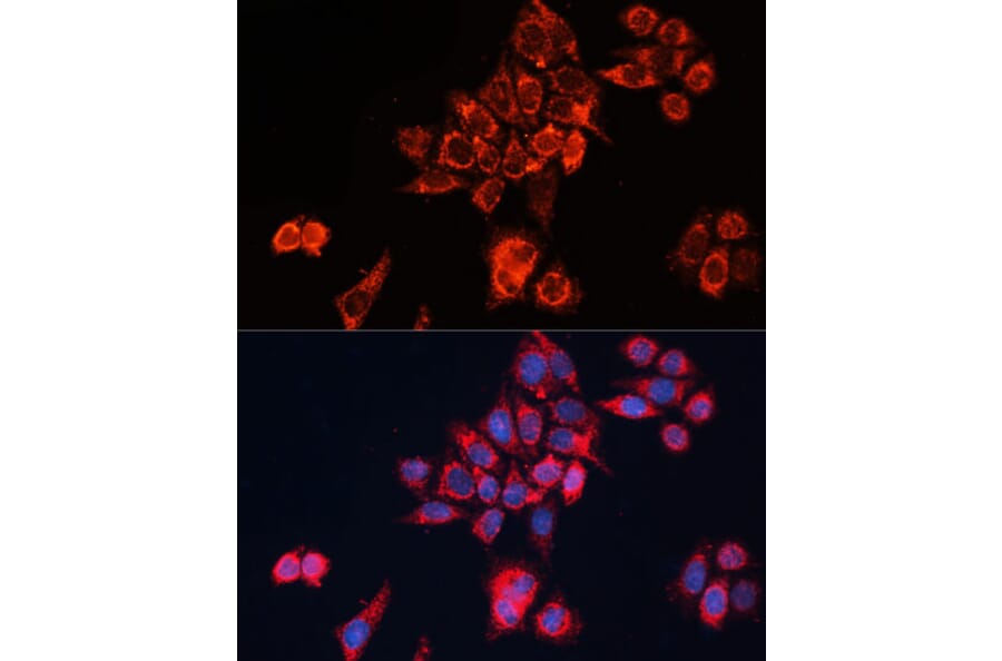 Immunofluorescence - Anti-GNAI2 Antibody (A92125) - Antibodies.com