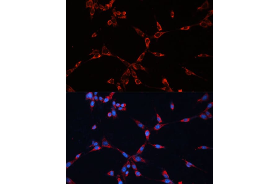 Immunofluorescence - Anti-GNAI2 Antibody (A92125) - Antibodies.com