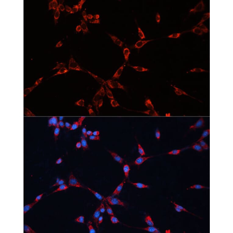 Immunofluorescence - Anti-GNAI2 Antibody (A92125) - Antibodies.com