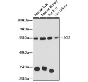 Western Blot - Anti-PECI Antibody (A92126) - Antibodies.com