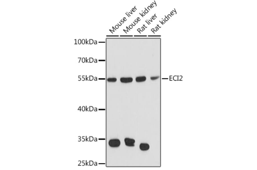 Western Blot - Anti-PECI Antibody (A92126) - Antibodies.com