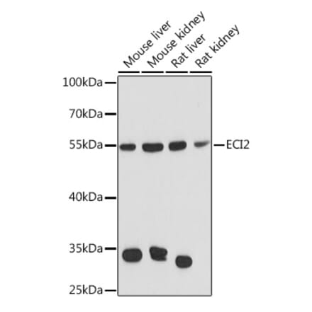 Western Blot - Anti-PECI Antibody (A92126) - Antibodies.com