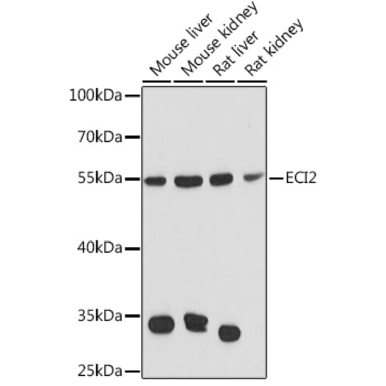 Western Blot - Anti-PECI Antibody (A92126) - Antibodies.com