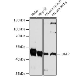 Western Blot - Anti-ILKAP Antibody (A92131) - Antibodies.com
