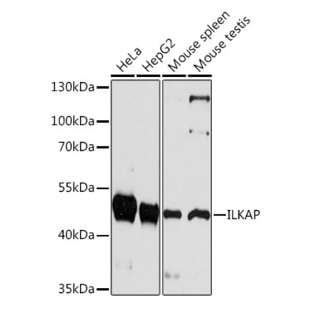 Western Blot - Anti-ILKAP Antibody (A92131) - Antibodies.com