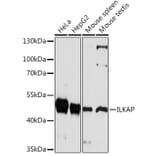 Western Blot - Anti-ILKAP Antibody (A92131) - Antibodies.com