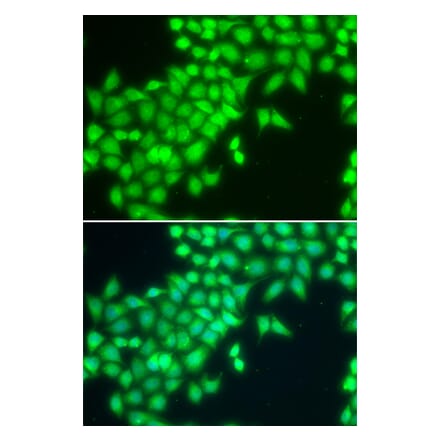 Immunofluorescence - Anti-METTL2A Antibody (A92132) - Antibodies.com