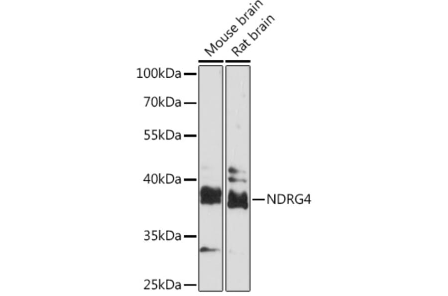 Western Blot - Anti-NDRG4 Antibody (A92134) - Antibodies.com