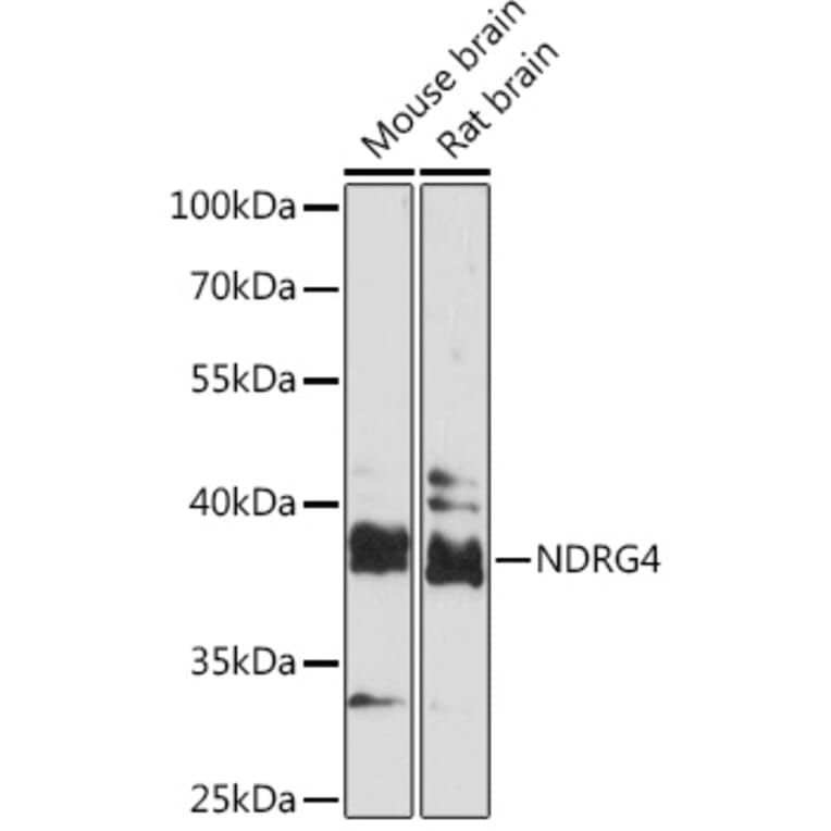 Western Blot - Anti-NDRG4 Antibody (A92134) - Antibodies.com