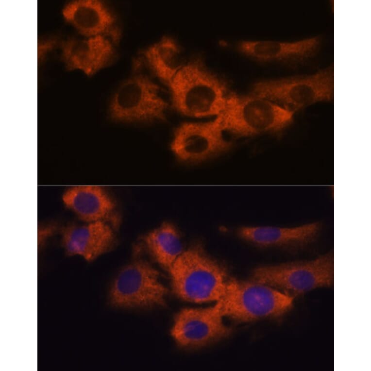 Immunofluorescence - Anti-NDRG4 Antibody (A92134) - Antibodies.com