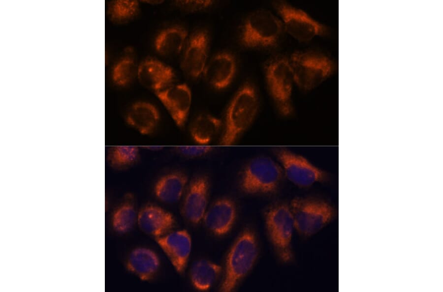 Immunofluorescence - Anti-NDRG4 Antibody (A92134) - Antibodies.com