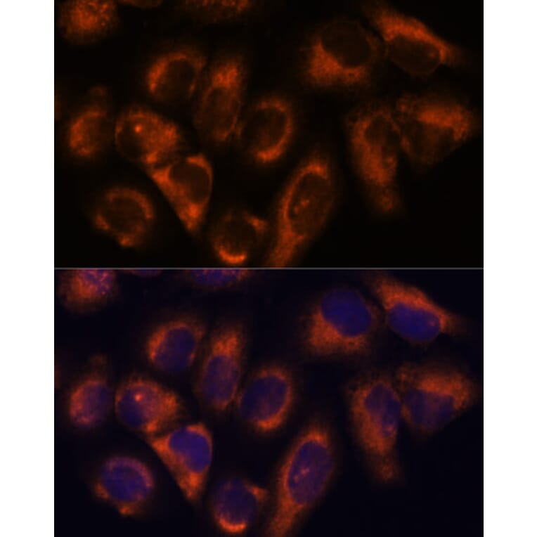 Immunofluorescence - Anti-NDRG4 Antibody (A92134) - Antibodies.com