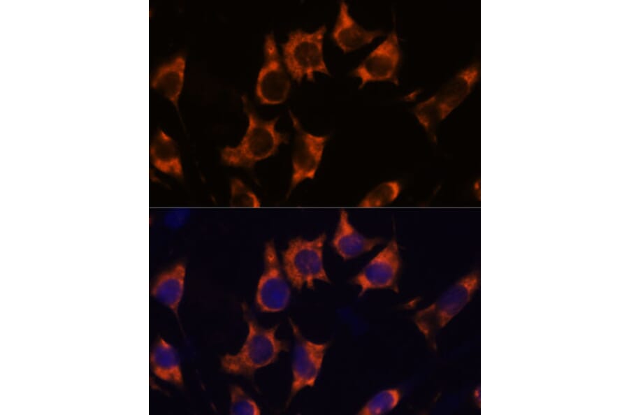 Immunofluorescence - Anti-NDRG4 Antibody (A92134) - Antibodies.com