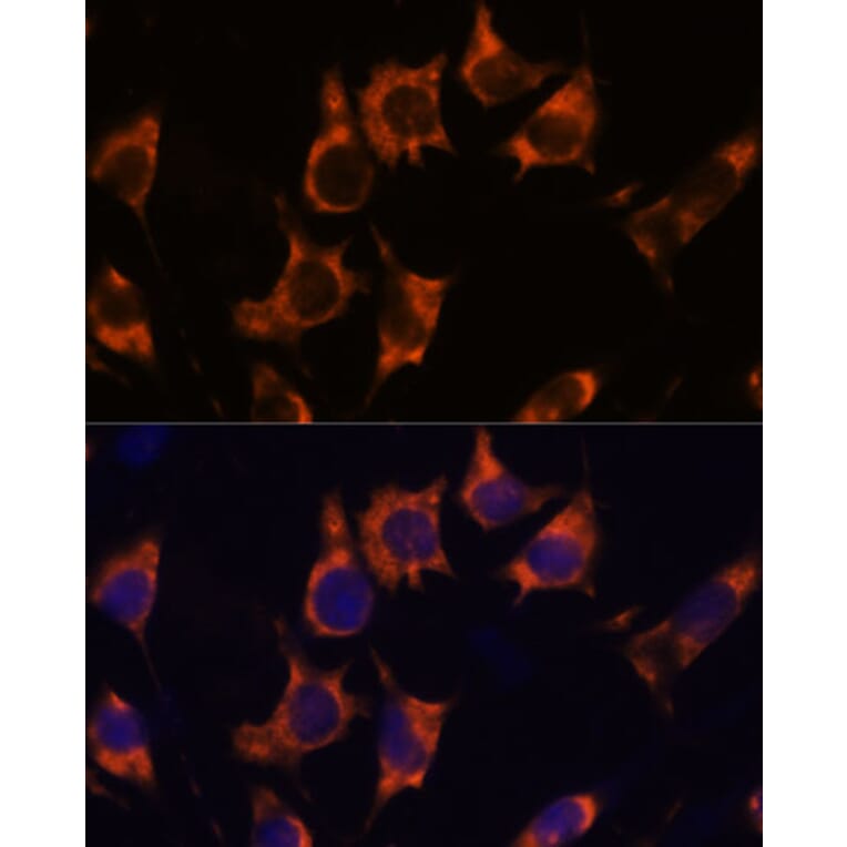 Immunofluorescence - Anti-NDRG4 Antibody (A92134) - Antibodies.com