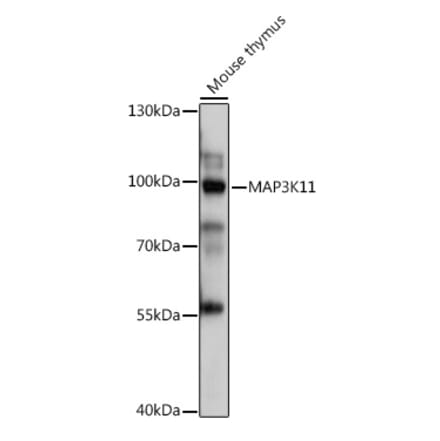 Western Blot - Anti-MLK3 Antibody (A92135) - Antibodies.com