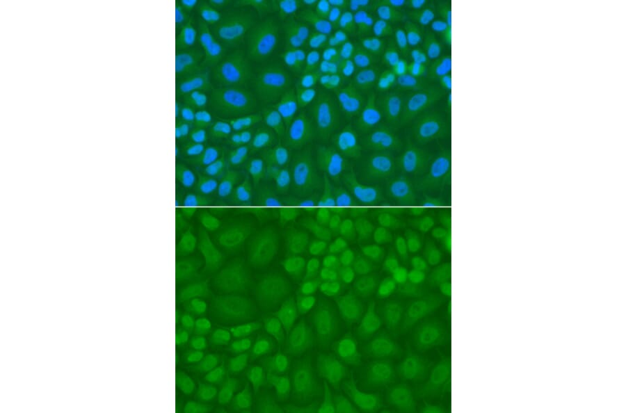 Immunofluorescence - Anti-TDG Antibody (A13365) - Antibodies.com