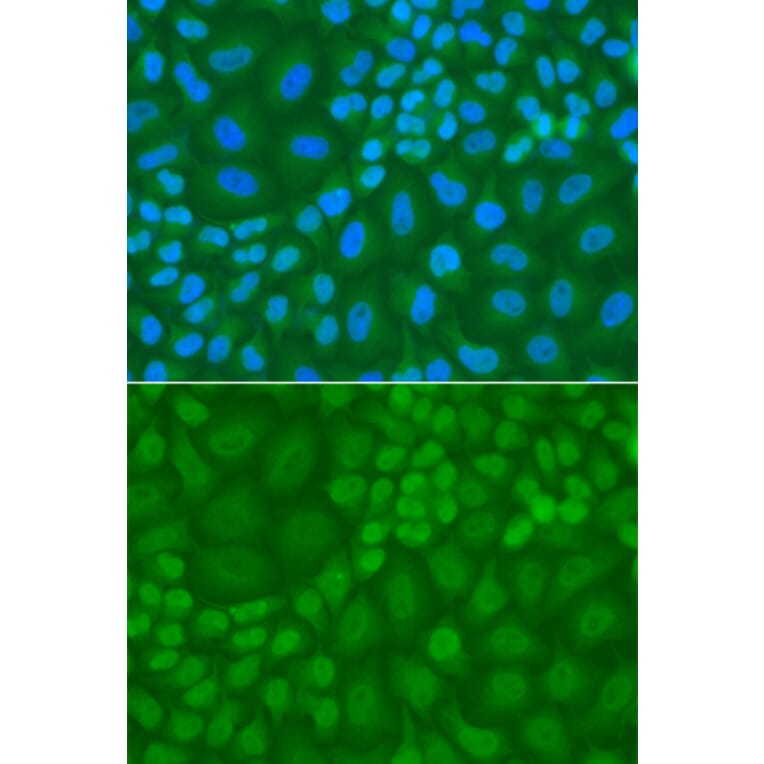 Immunofluorescence - Anti-TDG Antibody (A13365) - Antibodies.com
