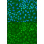 Immunofluorescence - Anti-TDG Antibody (A13365) - Antibodies.com