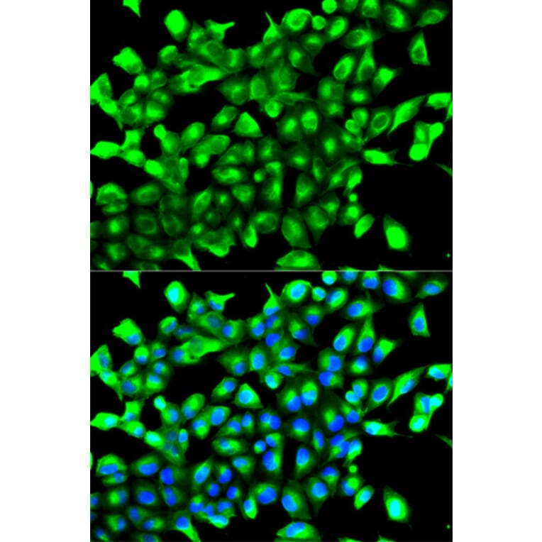 Immunofluorescence - Anti-PHD2/prolyl hydroxylase Antibody (A92138) - Antibodies.com