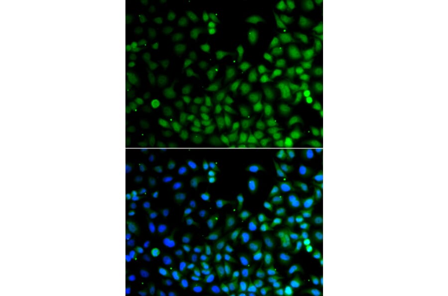 Immunofluorescence - Anti-LHX6 Antibody (A13413) - Antibodies.com