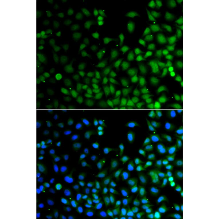 Immunofluorescence - Anti-LHX6 Antibody (A13413) - Antibodies.com