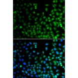 Immunofluorescence - Anti-LHX6 Antibody (A13413) - Antibodies.com