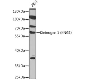 Western Blot - Anti-Kininogen 1 Antibody (A92143) - Antibodies.com