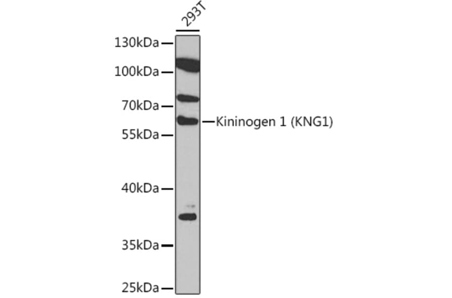 Western Blot - Anti-Kininogen 1 Antibody (A92143) - Antibodies.com