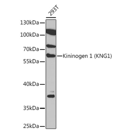 Western Blot - Anti-Kininogen 1 Antibody (A92143) - Antibodies.com