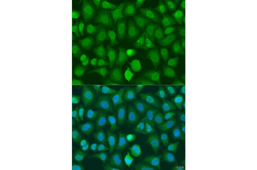 Immunofluorescence - Anti-CHD1 Antibody (A15038) - Antibodies.com