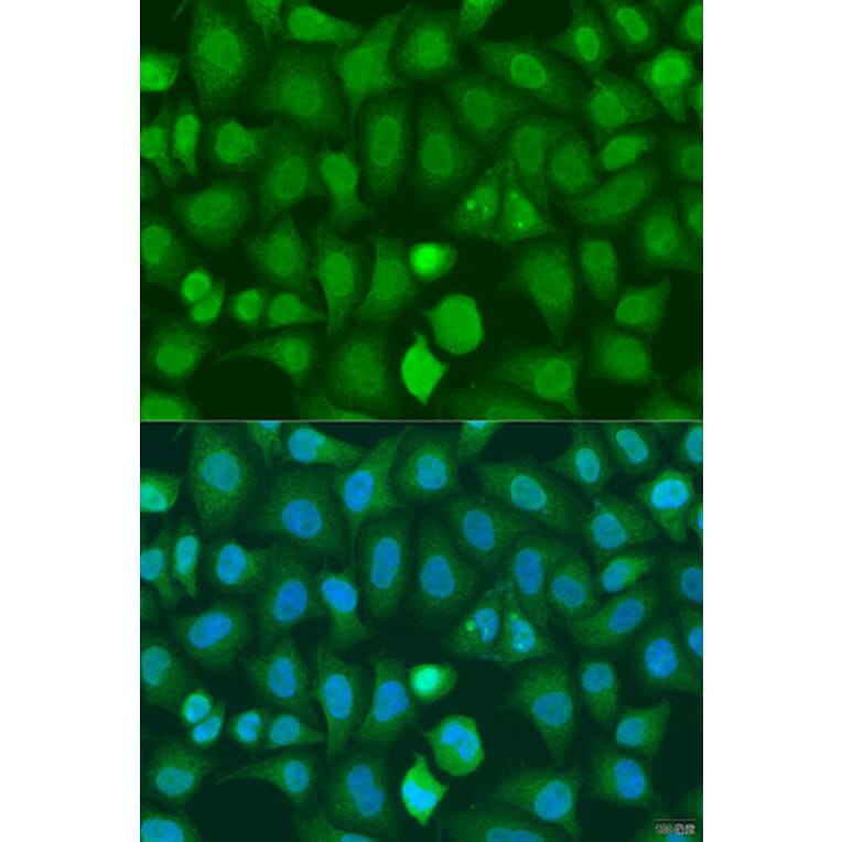 Immunofluorescence - Anti-CHD1 Antibody (A15038) - Antibodies.com