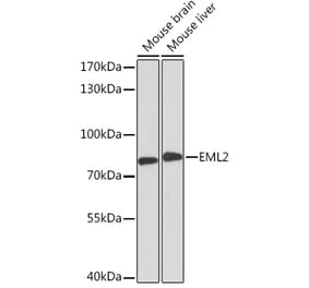 Western Blot - Anti-EML2 Antibody (A92146) - Antibodies.com