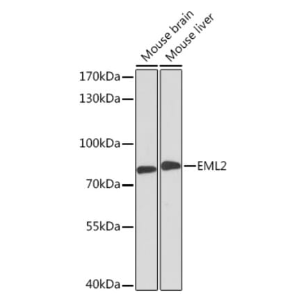 Western Blot - Anti-EML2 Antibody (A92146) - Antibodies.com