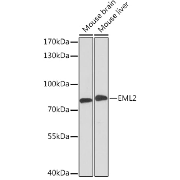 Western Blot - Anti-EML2 Antibody (A92146) - Antibodies.com