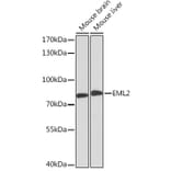 Western Blot - Anti-EML2 Antibody (A92146) - Antibodies.com