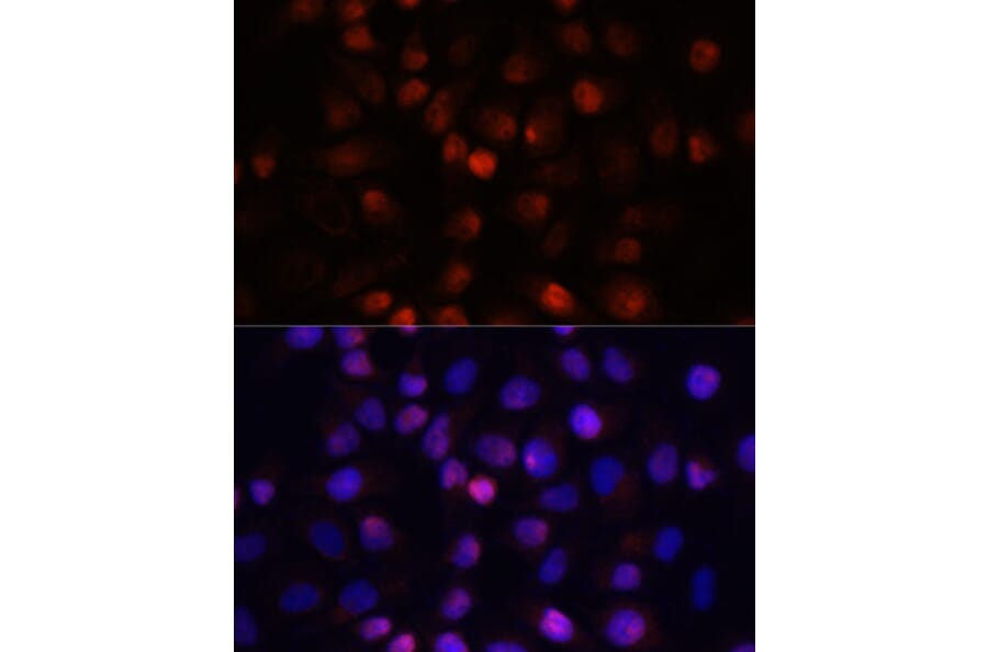 Immunofluorescence - Anti-ACP1 Antibody (A15020) - Antibodies.com