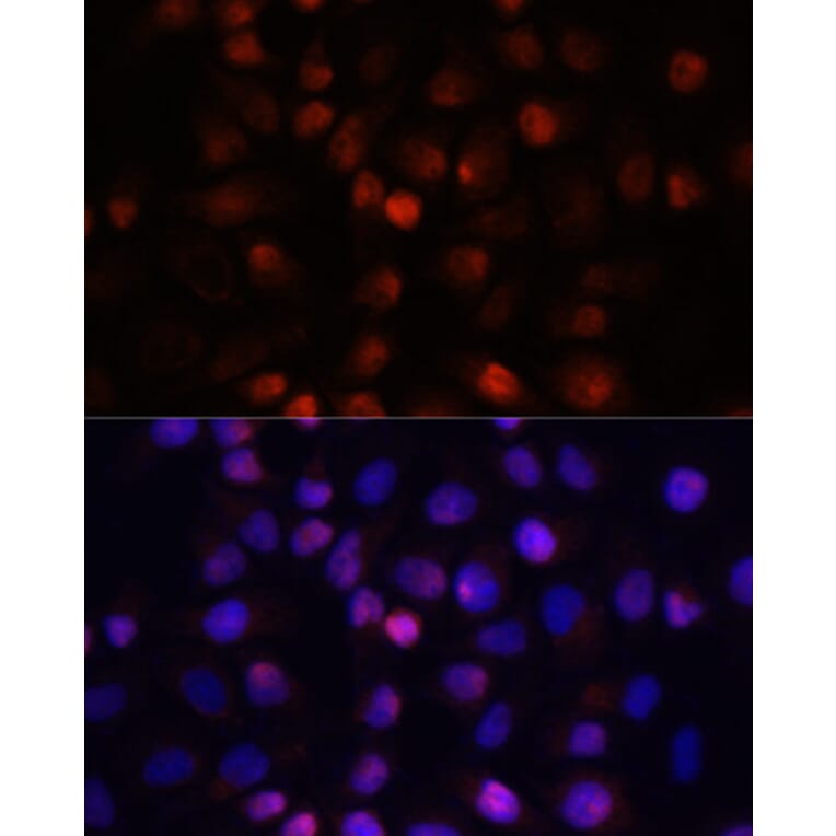 Immunofluorescence - Anti-ACP1 Antibody (A15020) - Antibodies.com