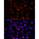 Immunofluorescence - Anti-ACP1 Antibody (A15020) - Antibodies.com