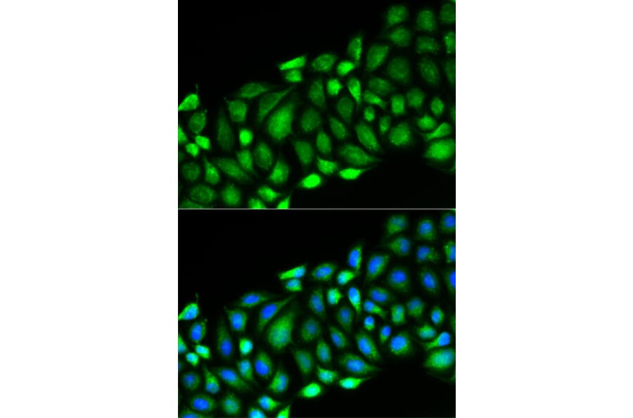Immunofluorescence - Anti-RIPK2 Antibody (A13381) - Antibodies.com