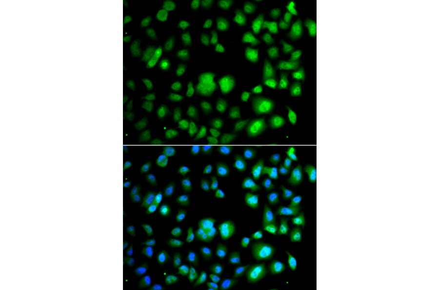 Immunofluorescence - Anti-TET3 Antibody (A92154) - Antibodies.com