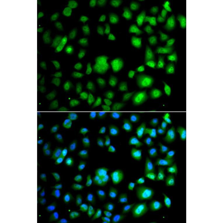 Immunofluorescence - Anti-TET3 Antibody (A92154) - Antibodies.com