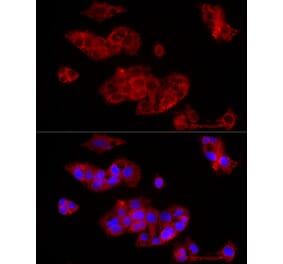 Immunofluorescence - Anti-FGF1 Antibody (A92157) - Antibodies.com