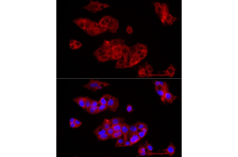 Immunofluorescence - Anti-FGF1 Antibody (A92157) - Antibodies.com