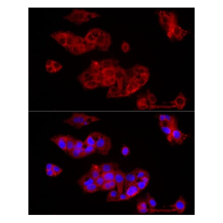 Immunofluorescence - Anti-FGF1 Antibody (A92157) - Antibodies.com